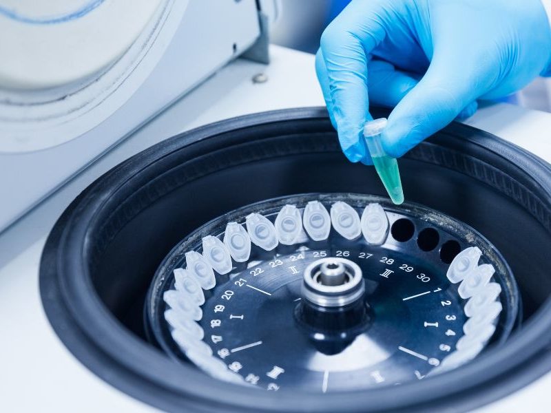 Things To Consider When Choosing a Centrifuge for Your Lab