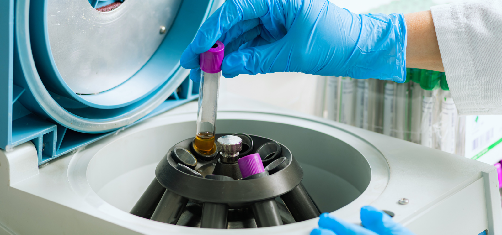 Unleashing the Power of Centrifugation: Applications and Best Practices